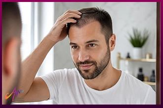 نتيجة زراعة الشعر بعد شهرين